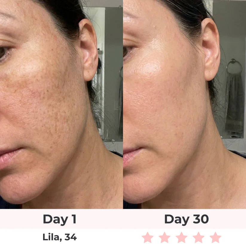LUMAE 7-in-1 LED Facial Sculptor