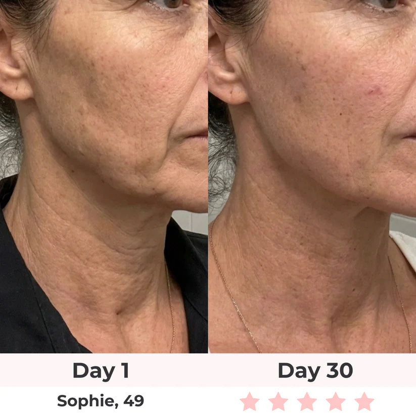 LUMAE 7-in-1 LED Facial Sculptor