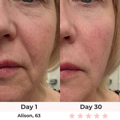 LUMAE 7-in-1 LED Facial Sculptor