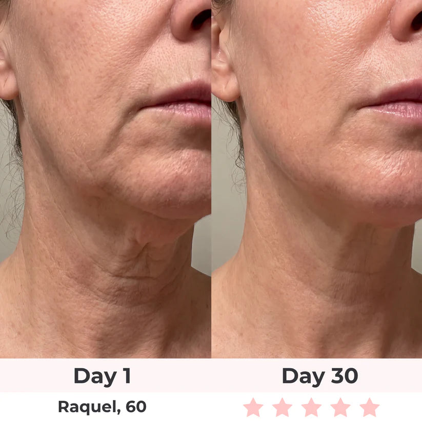 LUMAE 7-in-1 LED Facial Sculptor
