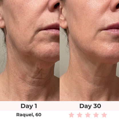 LUMAE 7-in-1 LED Facial Sculptor