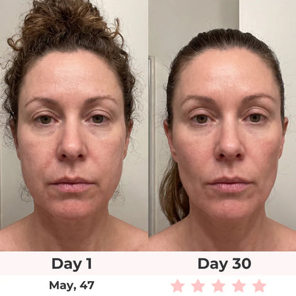 LUMAE 7-in-1 LED Facial Sculptor