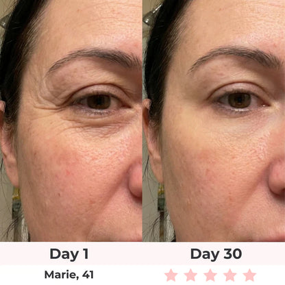 LUMAE 7-in-1 LED Facial Sculptor