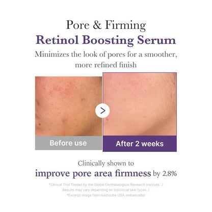 Retinol NMN Boosting Serum - 30 ML